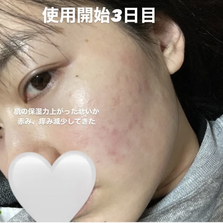 セラム ヴェール/ONE BY KOSE/美容液を使ったクチコミ（3枚目）