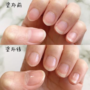 ネイルケール スーパーフード ベースコート Nails Inc の口コミ ネイルズインクネイルケールスーパーフードベ By ぷりんちゃ 乾燥肌 代後半 Lips