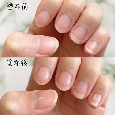 ネイルケール スーパーフード ベースコート/nails inc./ネイルトップコート・ベースコートを使ったクチコミ（3枚目）