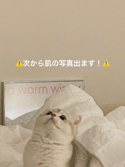 Abib 弱酸性pHシートマスク ハニーフィットのクチコミ「赤いニキビも消えた!これは大優勝すぎて手放せないかも...
なんとまた LIPS のプレ.....」(3枚目)