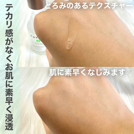 ノスカナイン トラブル セラム/FATION/美容液を使ったクチコミ(3枚目)