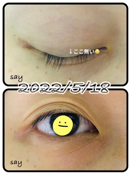 アイラッシュセラム/PHOEBE BEAUTY UP/まつげ美容液を使ったクチコミ(1枚目)