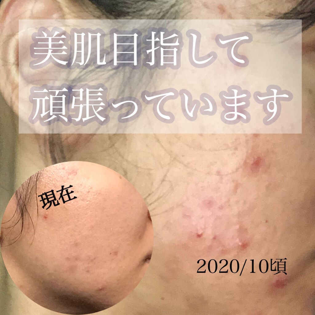 モイストバランス  ローション/ACSEINE/化粧水を使ったクチコミ(1枚目)