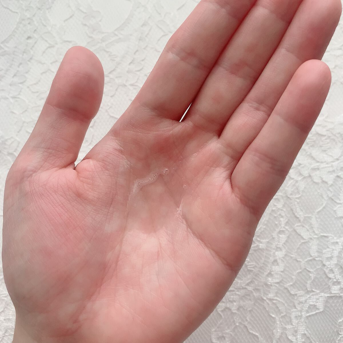 薬用スカルプセラム/wicot/頭皮ローションを使ったクチコミ(3枚目)