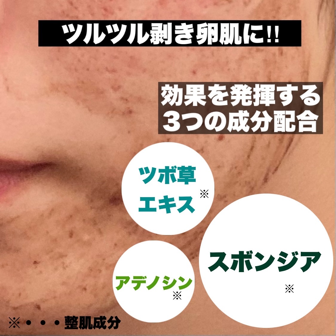 ダーマスキンピーリング/BQCELL/その他キットセットを使ったクチコミ（2枚目）