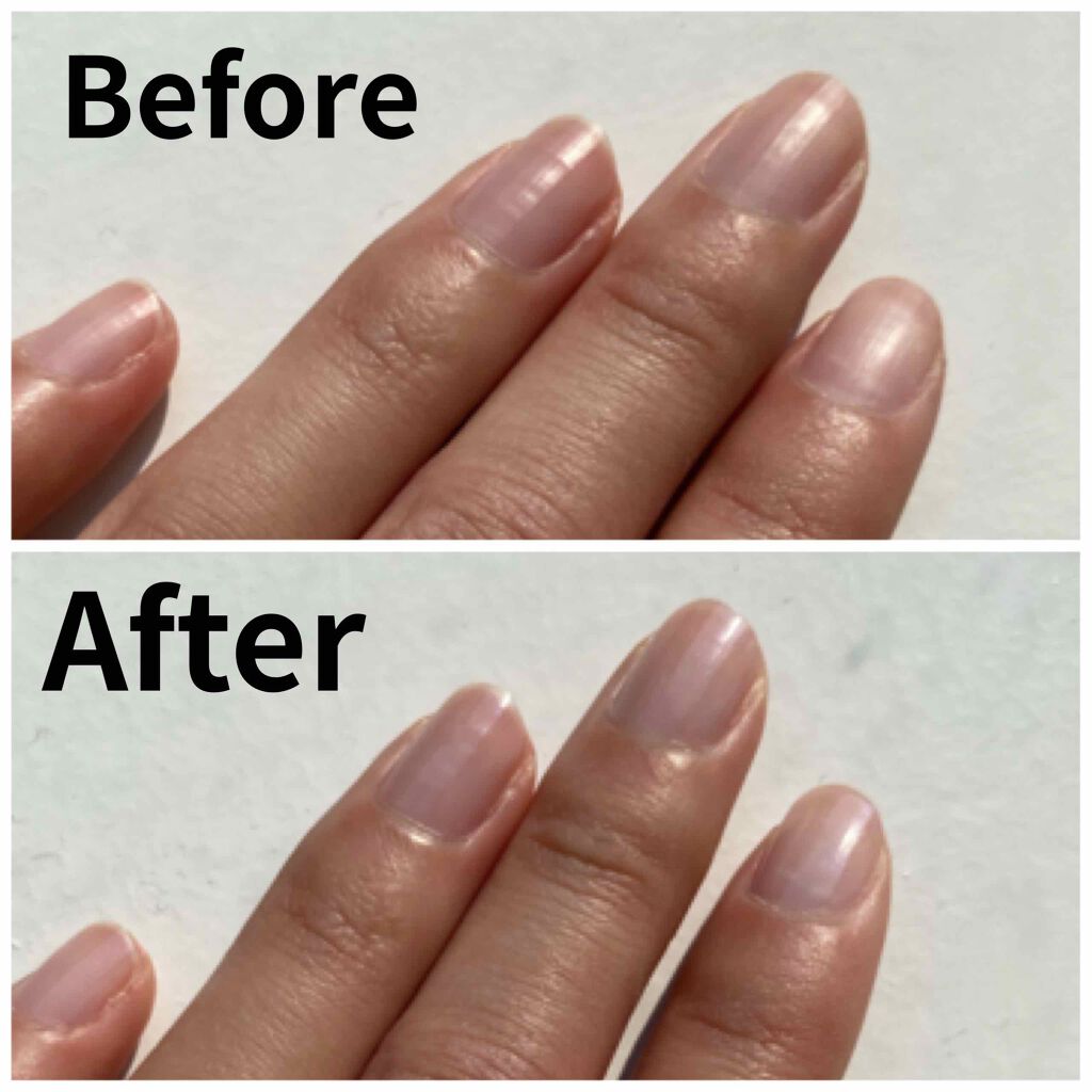 ネイルホリック ベースコート/ネイルホリック/ネイルベースコートを使ったクチコミ（2枚目）