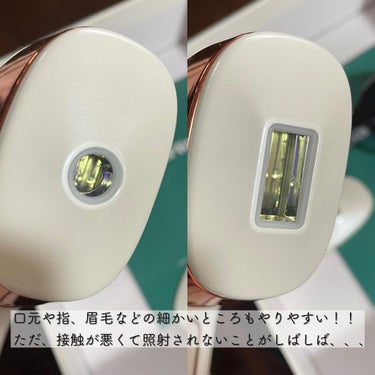 光脱毛器 VIO/Sarlisi/家庭用脱毛器を使ったクチコミ（3枚目）