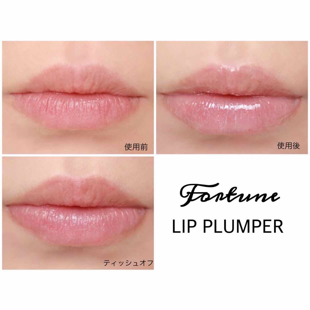 リッププランパー/フォーチュン/リッププランパーを使ったクチコミ(4枚目)