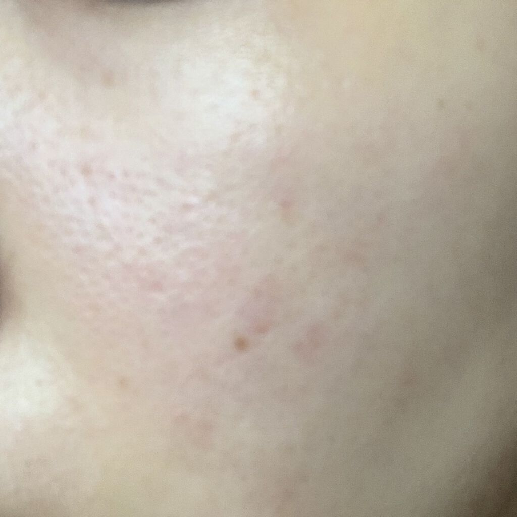 薬用 しみ 集中対策 美容液/メラノCC/美容液を使ったクチコミ（3枚目）