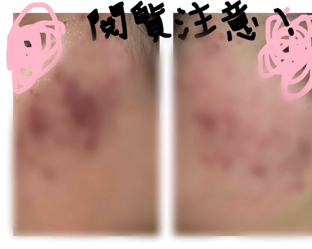 アルビオン 薬用スキンコンディショナー エッセンシャル/ALBION/化粧水を使ったクチコミ（1枚目）