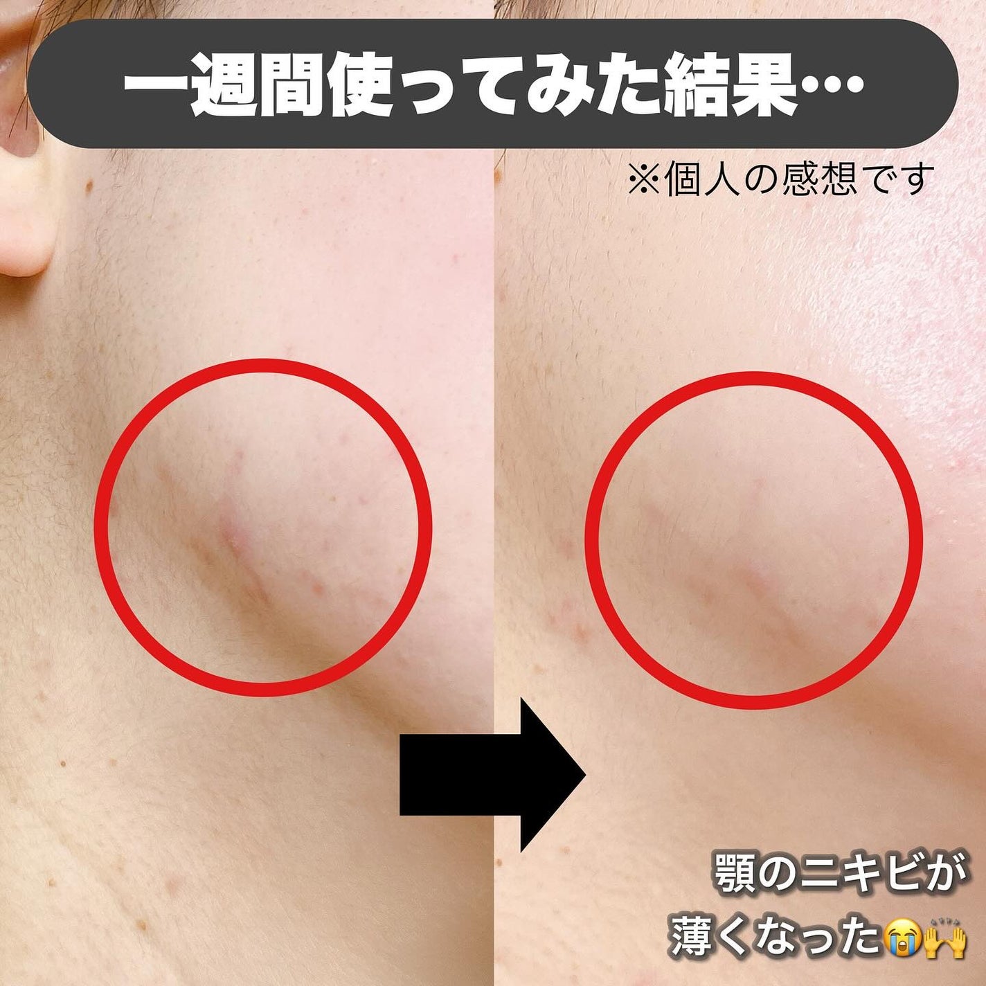 AZケア マスク/VT/シートマスク・パックを使ったクチコミ(5枚目)