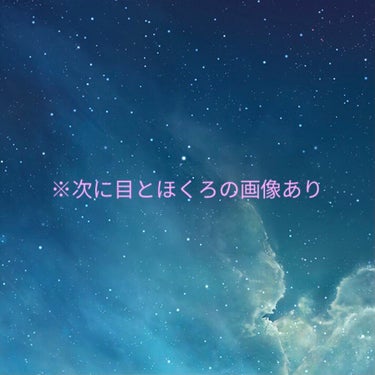 若干写真にぼかしを入れてもわかる存在感が大きい目の下のほくろ。
正直コンプレックスでいつか除去したいと思っていました。
ですが最近ちょっと受け入れられるようになった出来事がありました。

児童と関わる仕