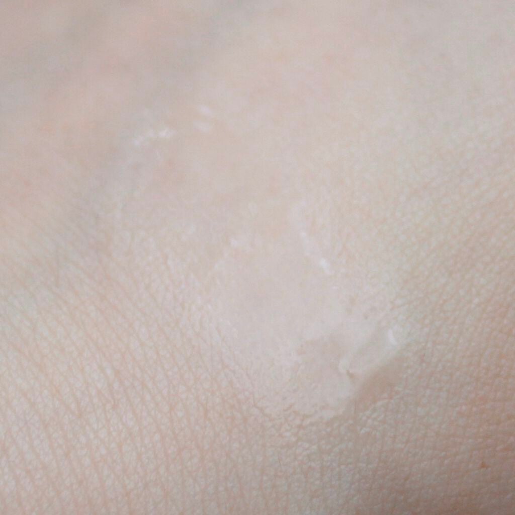 FDR アクネケア 化粧液/ファンケル/化粧水を使ったクチコミ(4枚目)