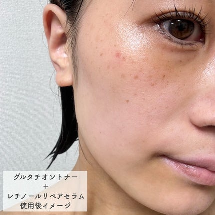 ヴィーガンリポソームレチノールセラム/SKIN&LAB/美容液を使ったクチコミ(6枚目)