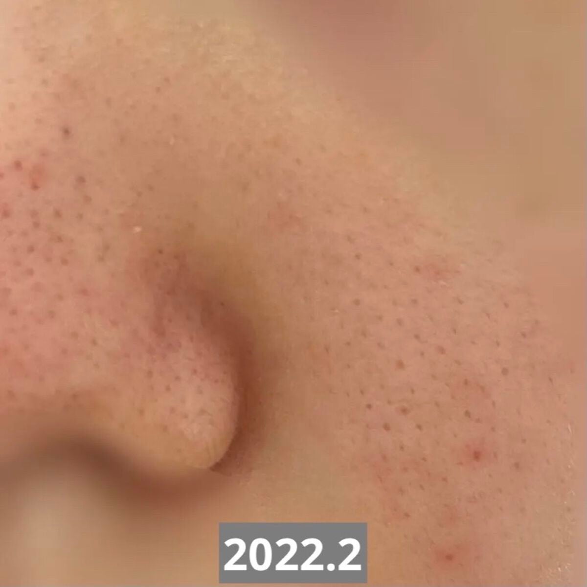 しろいるか on LIPS 「突然ですが、助けてください‼️前回の投稿から1年ほどが経ってし..」(3枚目)