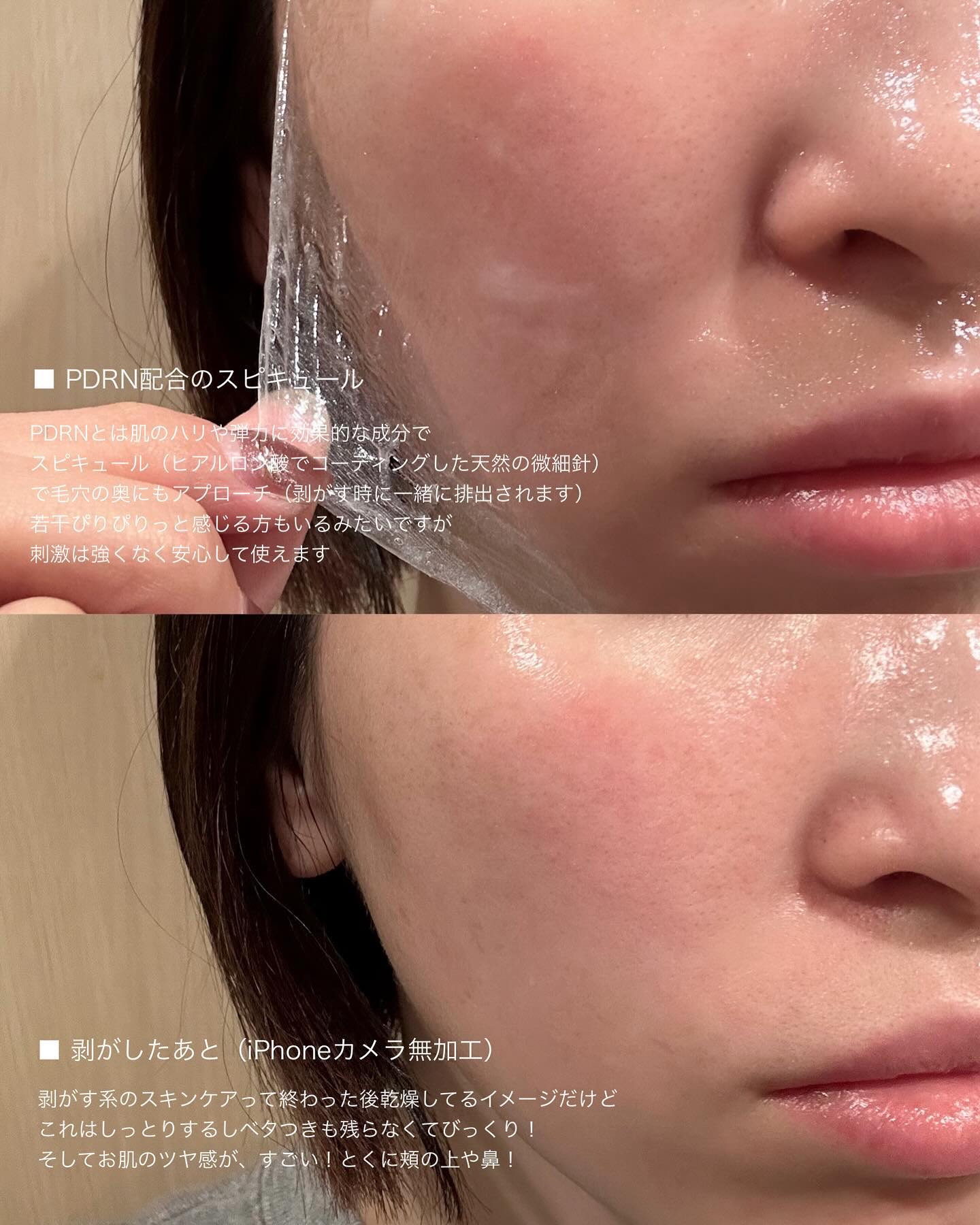 ピートピーディーアールエヌ ラッピングショット フィールオフマスク/One-day's you/シートマスク・パックを使ったクチコミ（3枚目）