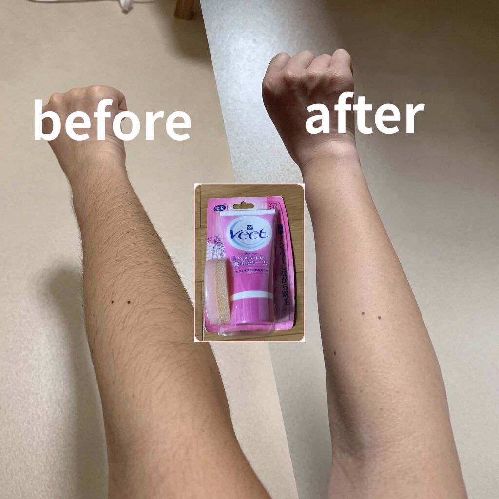 除毛クリームキット敏感肌用/エピラット/除毛クリームを使ったクチコミ(2枚目)