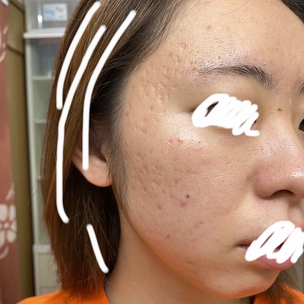 乳液・敏感肌用・しっとりタイプ/無印良品/乳液を使ったクチコミ（3枚目）