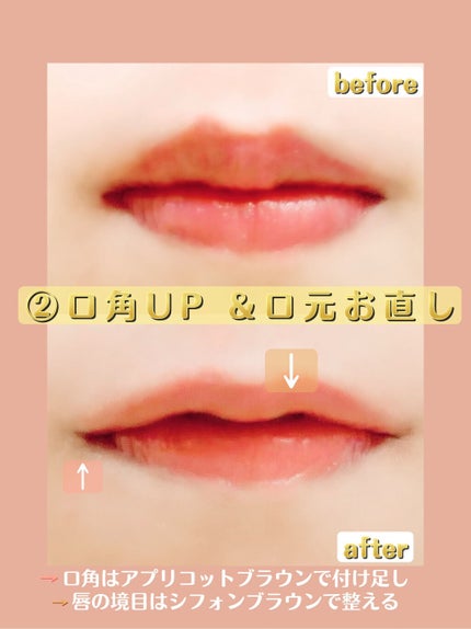 ã·ã«ããŒãªãããã¢ã€ã©ã€ããŒWP/D-UP/ãªãããã¢ã€ã©ã€ããŒã䜿ã£ãã¯ãã³ãïŒ5æç®ïŒ