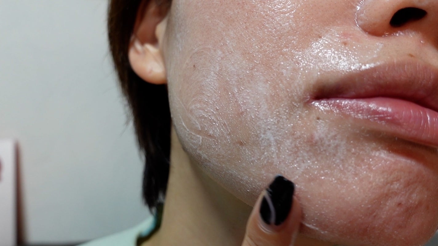 A-CICA ストレスリリーフクリームエッセンス/AESTURA/美容液を使ったクチコミ(6枚目)