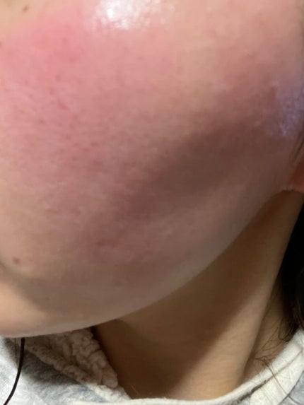 リンクルナイトクリーム/なめらか本舗/フェイスクリームを使ったクチコミ(2枚目)