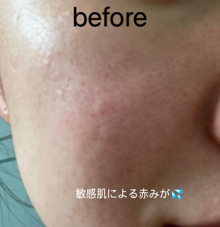 ピュアアルテミシア カーミングウォータークリーム/HANYUL(ハンユル)/フェイスクリームを使ったクチコミ(4枚目)