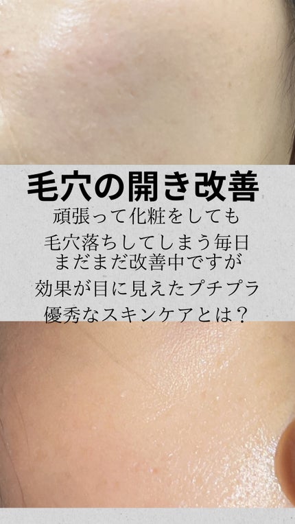 GGエッセンス/KISO/美容液を使ったクチコミ(1枚目)