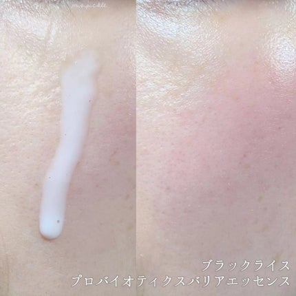 ブラックライス モイスチャー ディープクレンジングオイル/haruharu wonder/オイルクレンジングを使ったクチコミ(3枚目)