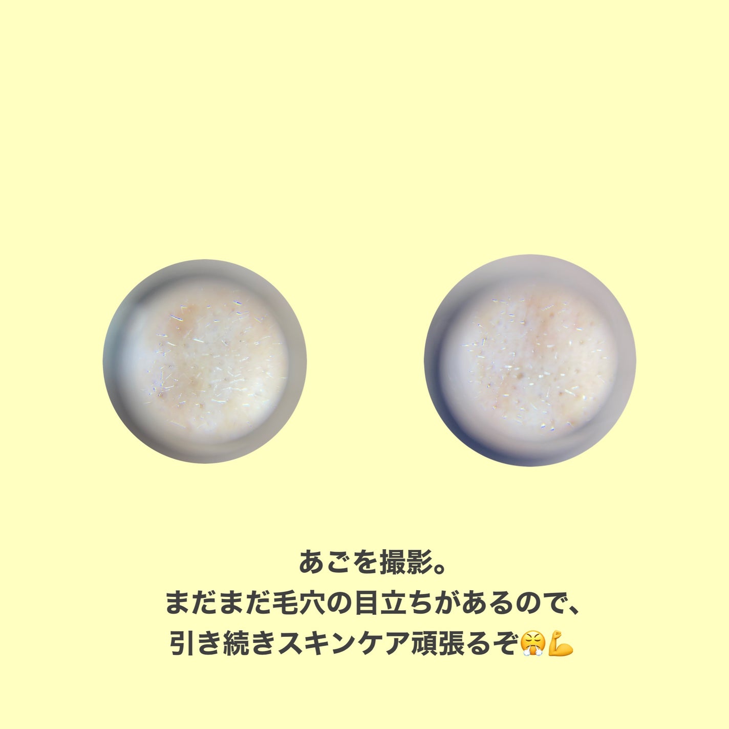 リードルショット300/VT/美容液を使ったクチコミ(5枚目)