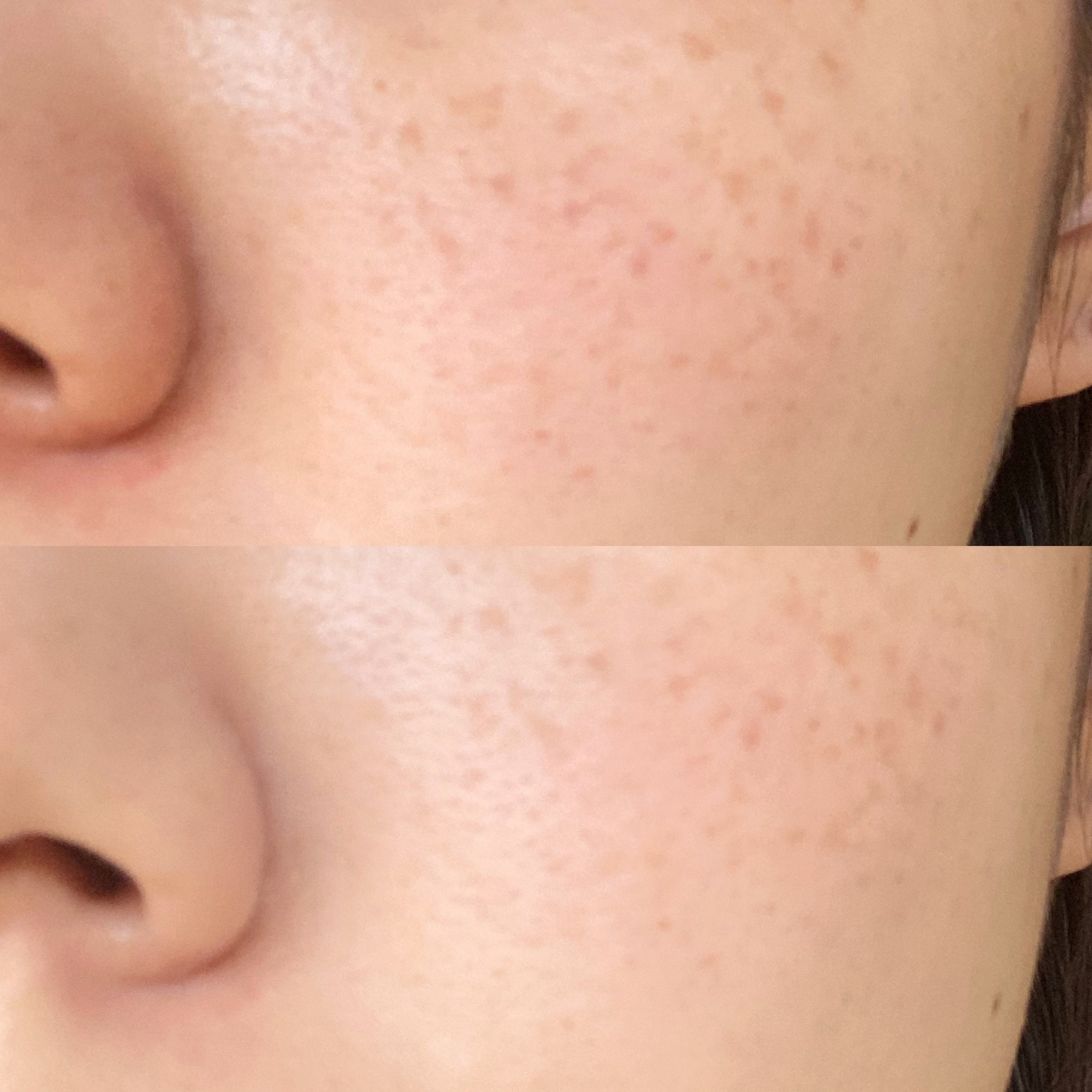 シカレチA エッセンス0.5/VT/美容液を使ったクチコミ（3枚目）