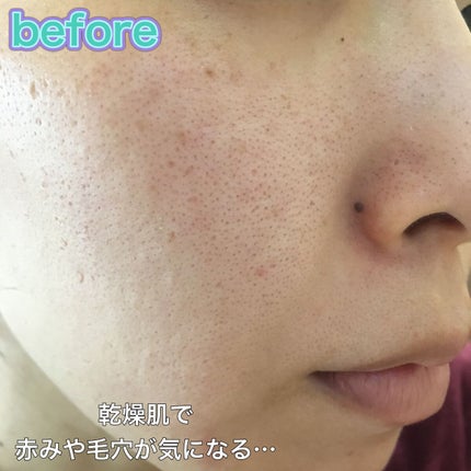 マスクフィットオールカバーデュアルコンシーラー/TIRTIR(ティルティル)/コンシーラーを使ったクチコミ(4枚目)