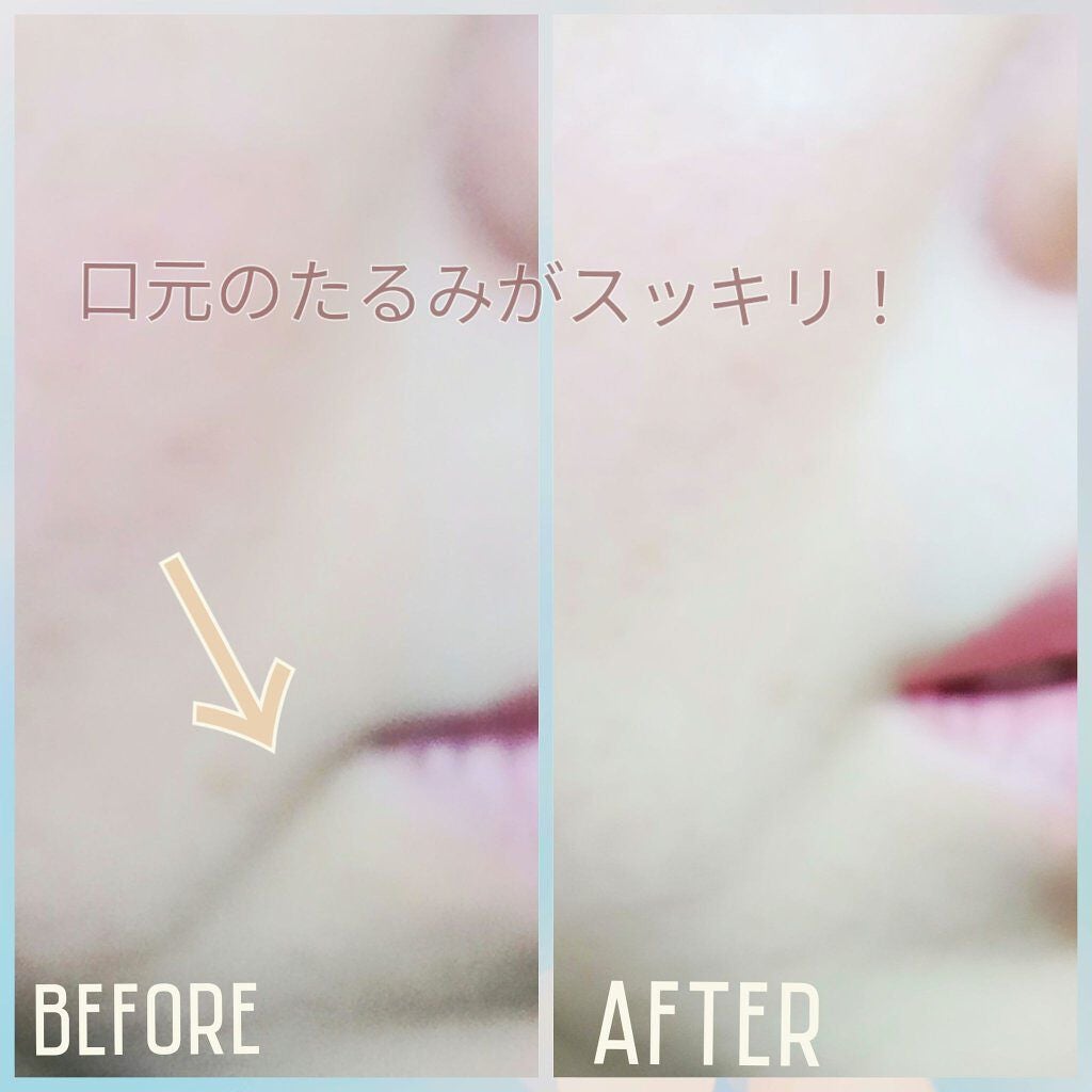 PLUMINUS/mous./美顔器・マッサージを使ったクチコミ(4枚目)