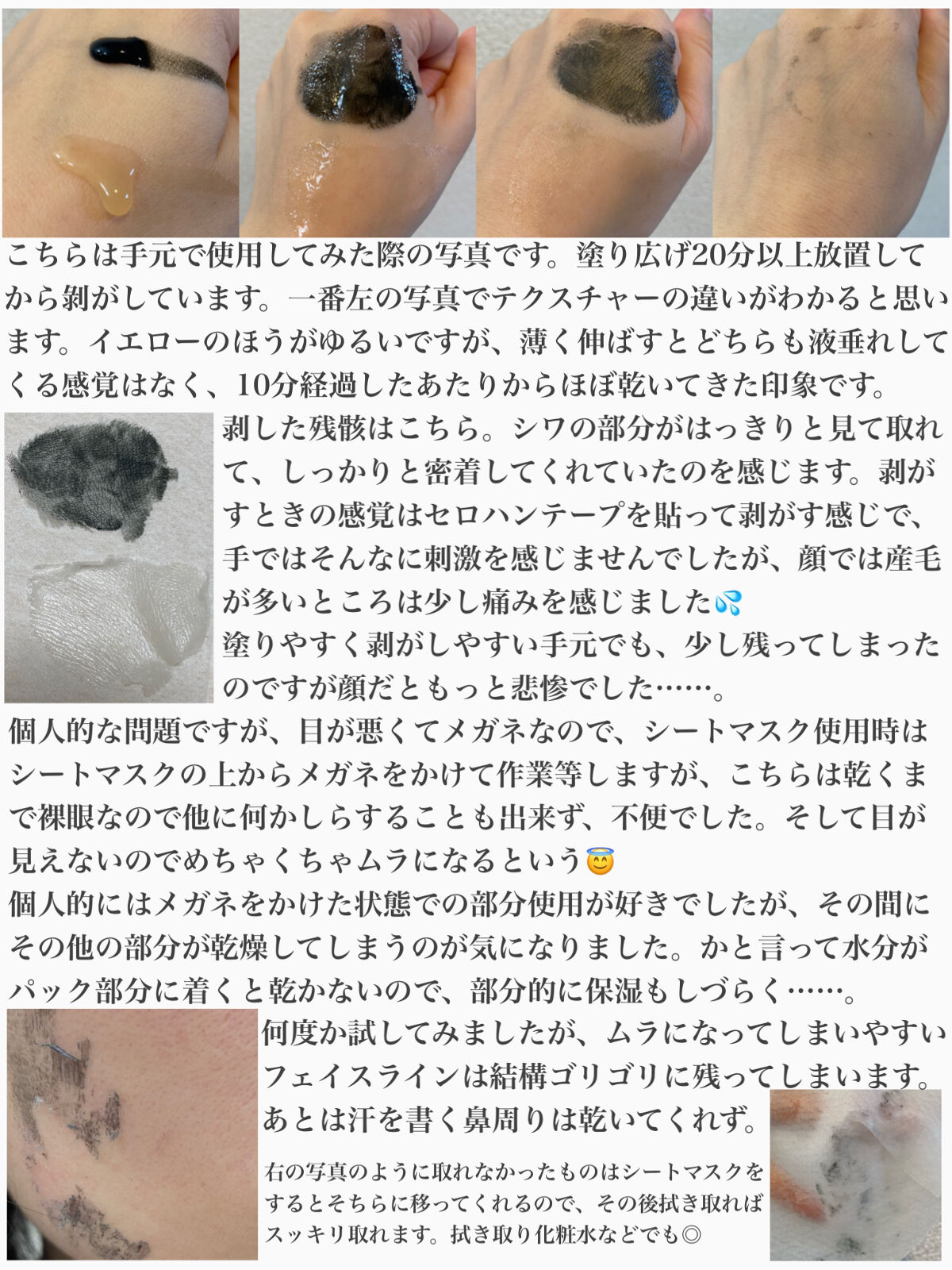 毛穴小町 イエローピールオフパック/クリアターン/ピーリングを使ったクチコミ（2枚目）