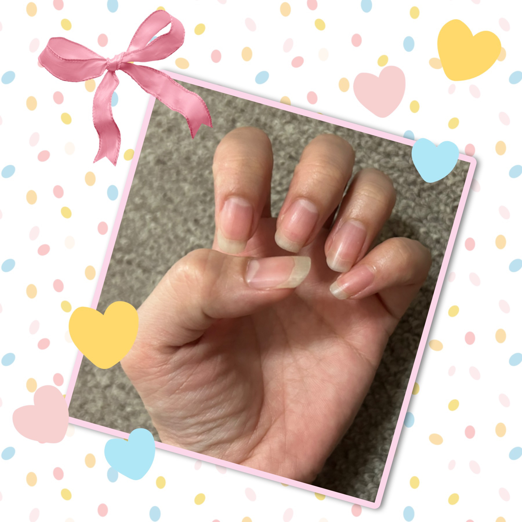 DAISO 爪切りのクチコミ「こんにちは！


こげたぱんです🍞


今回は、
＃爪日記　です。

7/26に切りました！
.....」（1枚目）