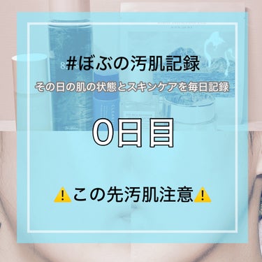 【脱肌荒れ！毎日スキンケア記録0日目】



約4年前の今頃…突然マスク生活を強いられ

マスクをすることが当たり前になったある日のこと

「あれ？頬に赤いポツポツが…」

そう…


        