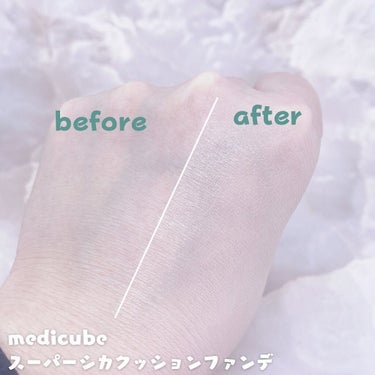 スーパーシカクッション/MEDICUBE/クッションファンデーションを使ったクチコミ（4枚目）