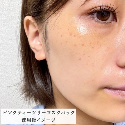 ピンクティーツリーマスクパック/APLIN/シートマスク・パックを使ったクチコミ(6枚目)
