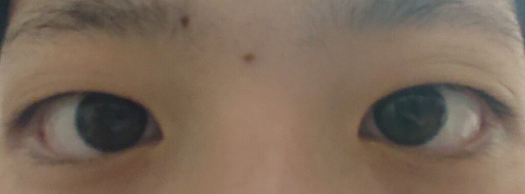 ストリングファイバー120 ディープタイプ/メザイク/二重まぶた用アイテムを使ったクチコミ（2枚目）