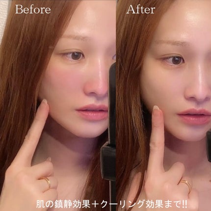 シカアンプルスティック/CHOSUNGAH BEAUTY/フェイスバームを使ったクチコミ(4枚目)