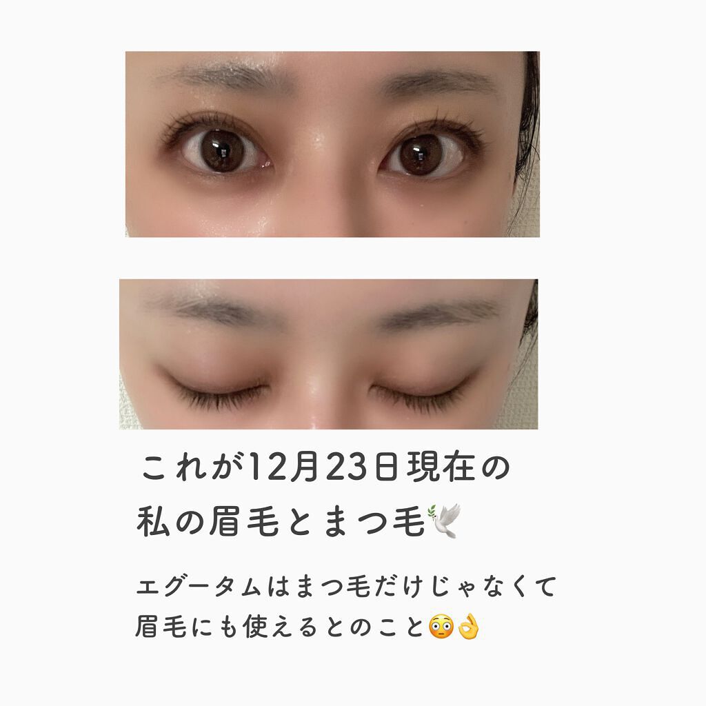 エグータム/アルマダスタイル/まつげ美容液を使ったクチコミ(4枚目)