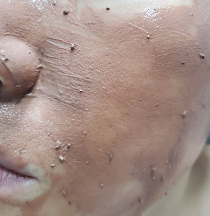 皮脂ごっそり毛穴パック/HANYUL(ハンユル)/洗い流すパック・マスクを使ったクチコミ(4枚目)