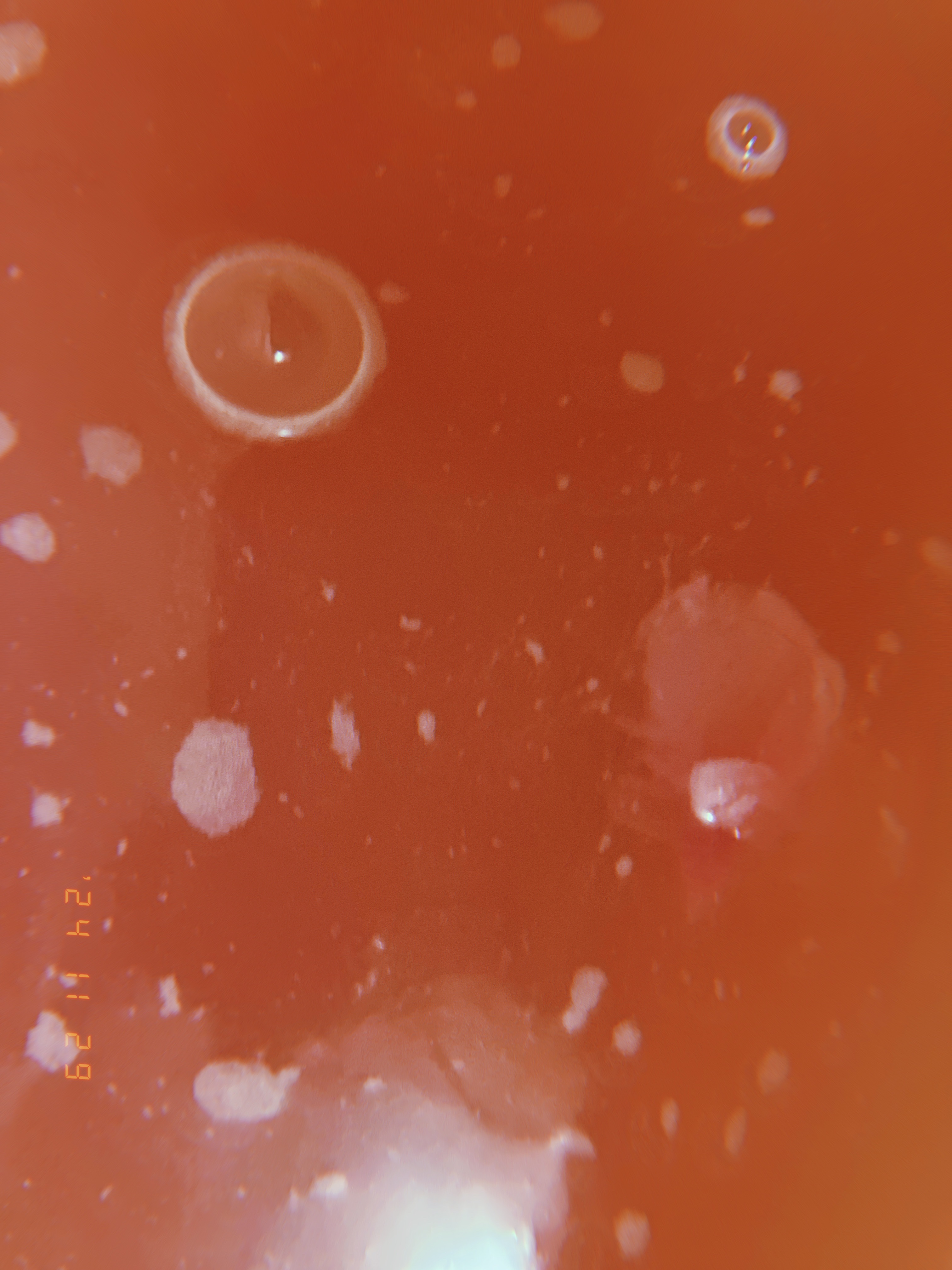 セクシー・ダイナマイト/ラッシュ/炭酸系入浴剤を使ったクチコミ（3枚目）