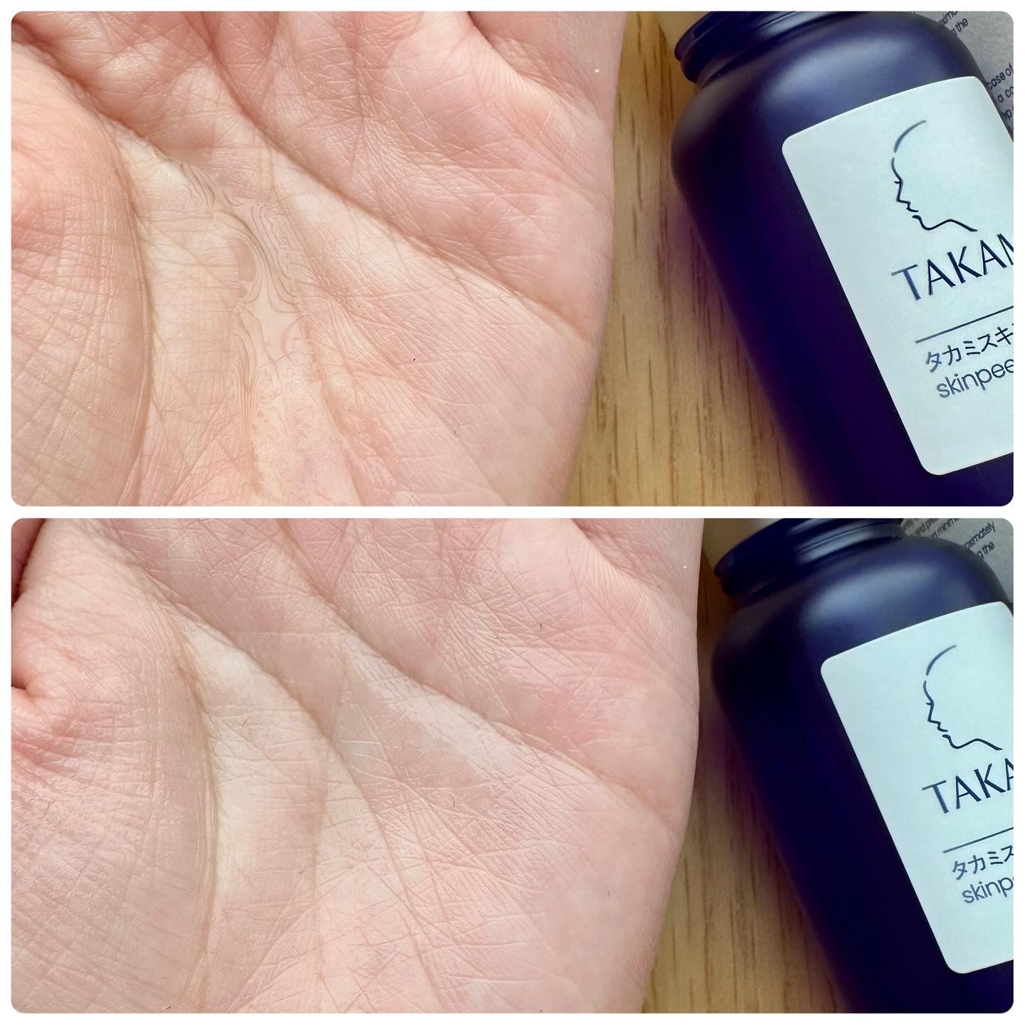 タカミスキンピール/タカミ/ブースター・導入液を使ったクチコミ（3枚目）