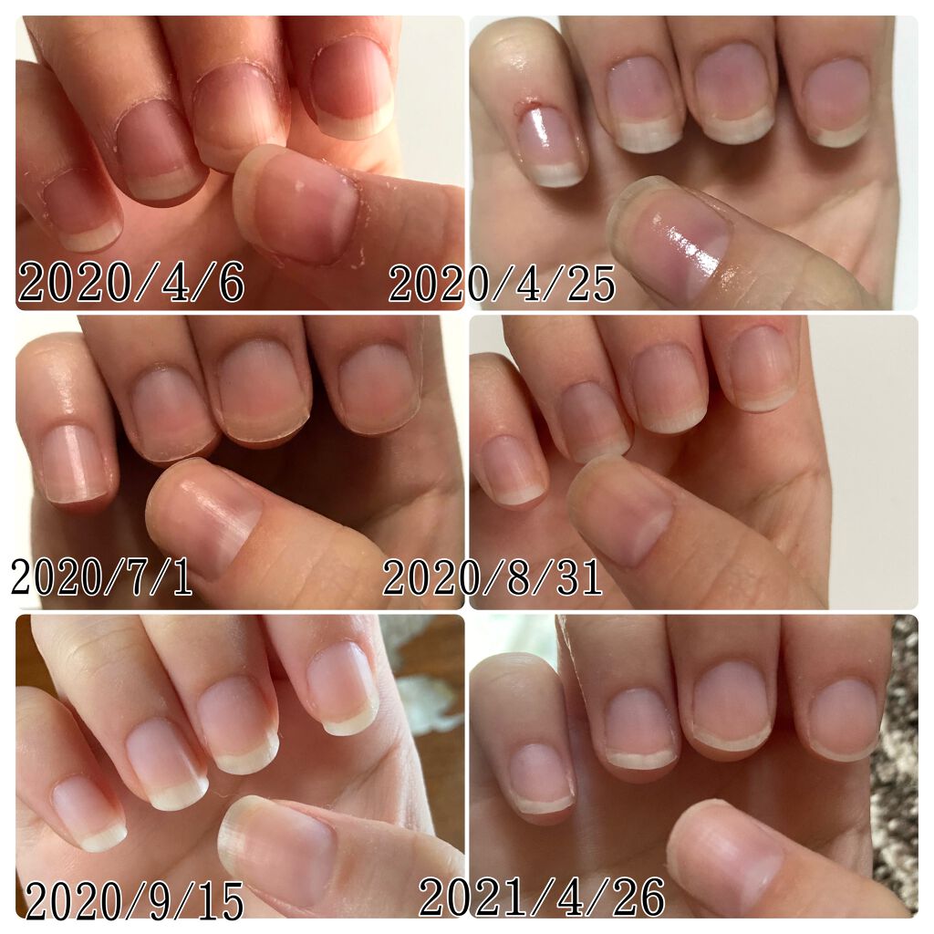 ハンドベール プレミアムリッチネイル/メンソレータム/ネイルオイル・トリートメントを使ったクチコミ（2枚目）