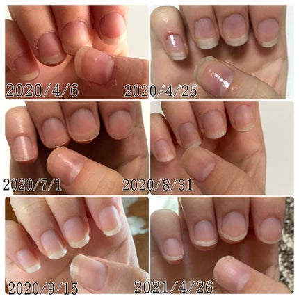 ハンドベール プレミアムリッチネイル/メンソレータム/ネイルオイル・トリートメントを使ったクチコミ(2枚目)