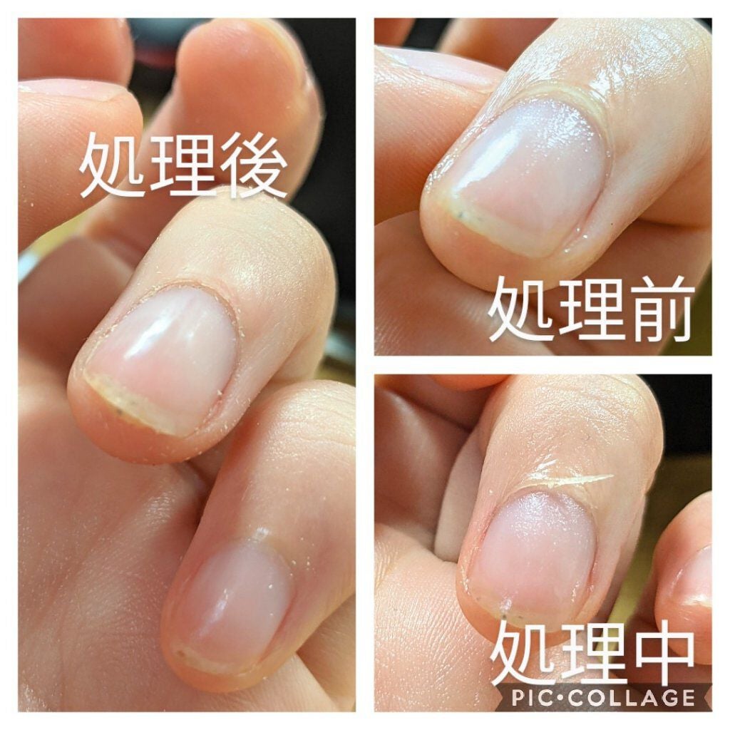 爪ミガキセット/デュカート/ネイル用品を使ったクチコミ(5枚目)