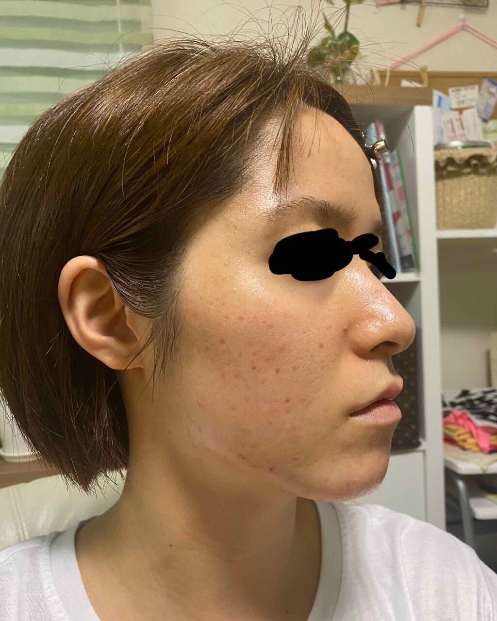 DHC ビタミンCハードカプセル/DHC/美容サプリメントを使ったクチコミ(1枚目)