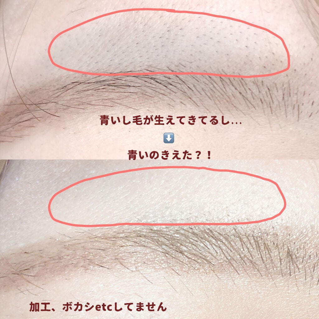 ニトリ フェイスシェイバー/ニトリ/シェーバーを使ったクチコミ(2枚目)