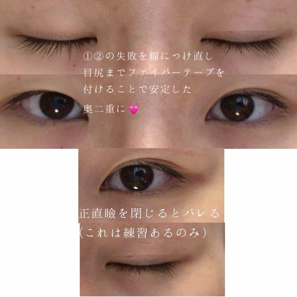 フリーファイバー120 スタンダードタイプ /メザイク/二重まぶた用アイテムを使ったクチコミ(7枚目)