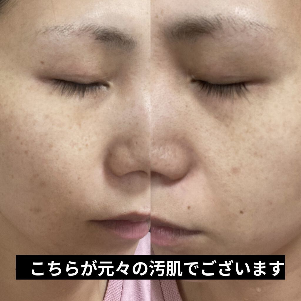 ミラミックス/ZO Skin Health/フェイスクリームを使ったクチコミ（3枚目）